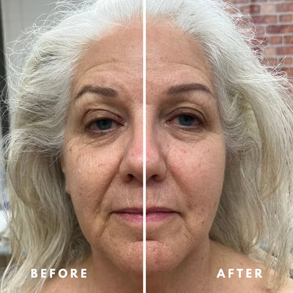 LymphGlow™ Face Sculpting Brush